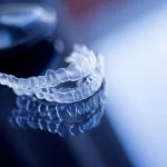 Invisalign czy zwykły aparat